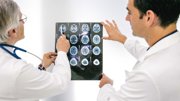 Científicos ya pueden predecir con exactitud el riesgo de un ictus a partir de los genes Salud