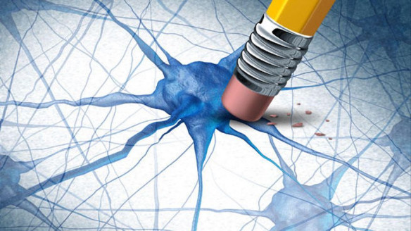 Desarrollan un nuevo enfoque para tratar el Alzheimer y crear una posible vacuna Salud