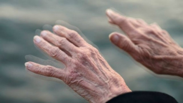 Kinesiología UCM convoca a pacientes a recibir nueva terapia para el Parkinson Salud