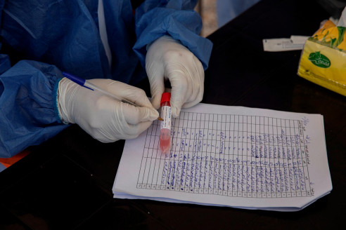 Una ciudad de Brasil podría haber alcanzado la inmunidad de rebaño para el COVID-19 Latinoamérica