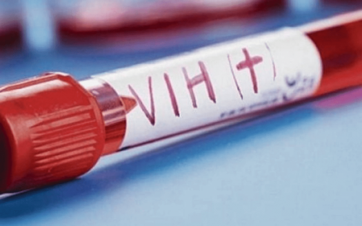 Riesgo de transmisión superior: detectan nueva variante del VIH en Países Bajos Salud