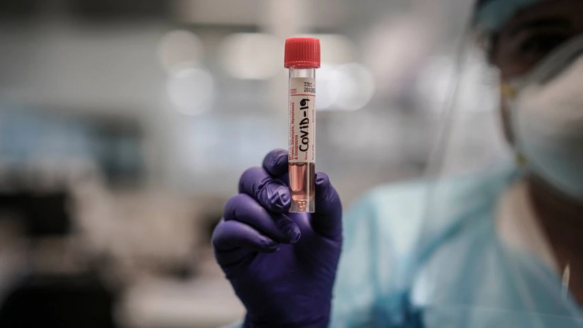 Casos nuevos de Covid-19 aumentaron en 47% la última semana Covid 19 - Coronavirus