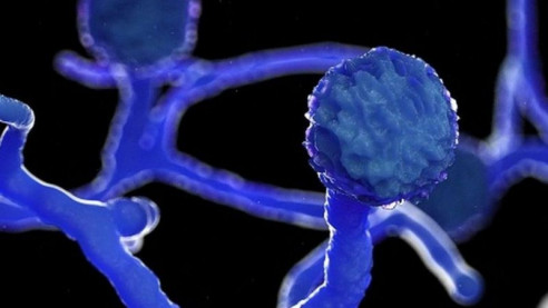 Detectan primer caso de la infección del