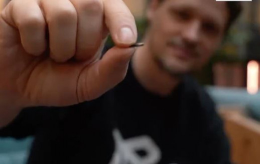 Esto es demasiado: Quieren implantar chip en los cuerpos como pase de movilidad Mundo