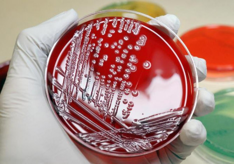 Superbacterias: Los antibióticos dejarán de funcionar si no se detiene su abuso ahora Mundo
