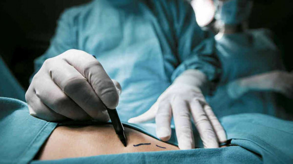 ¡Ley de especialidades médicas ahora! Sólo en diciembre han muerto dos mujeres por cirugías cuestionadas Salud