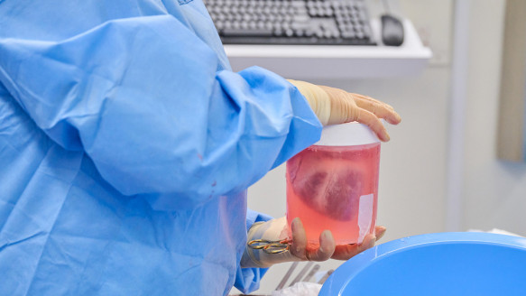 Aliviar la escasez de donantes: trasplantan con éxito corazones de cerdo a dos personas con muerte cerebral Salud
