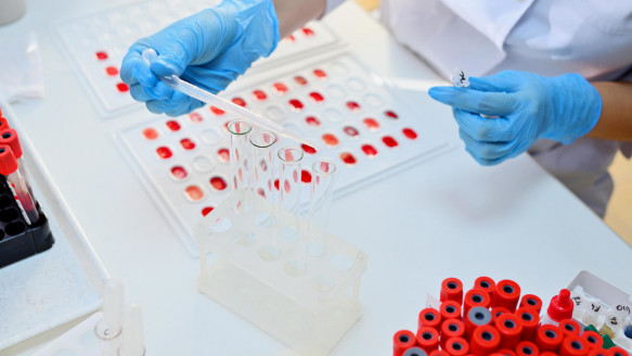 Científicos develan un vínculo causal entre el grupo sanguíneo y los casos más severos de covid-19 Salud