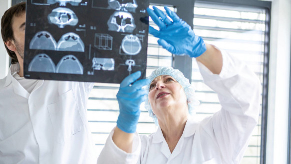 Revelan un aumento a escala mundial de los casos de cáncer en adultos menores de 50 años Salud