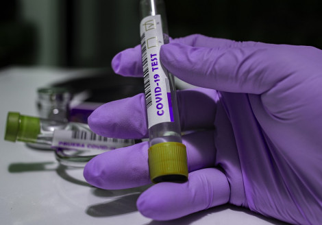 Descubren biomarcador capaz de predecir casos graves de COVID-19 Salud