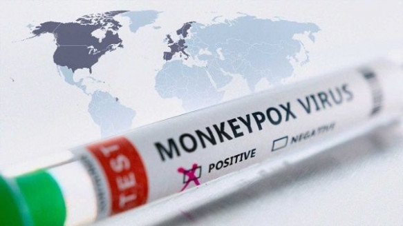 La Viruela del mono se ha extendido a mas de 20 países Salud