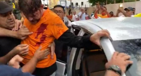 Un senador brasileño resultó herido de bala durante una protesta policial Brasil