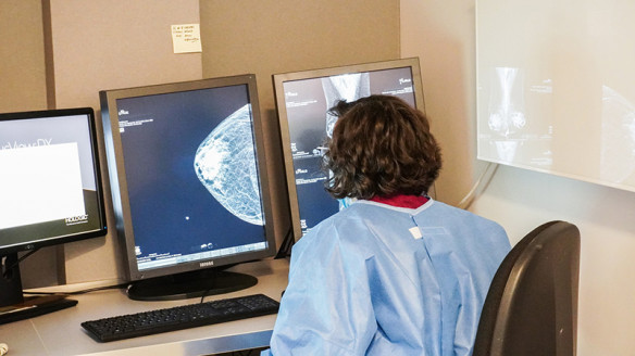 País desigual: Estudio evidencia diferentes tasas de letalidad y sobrevida por cáncer de mama según el tipo de previsión en Salud Chile