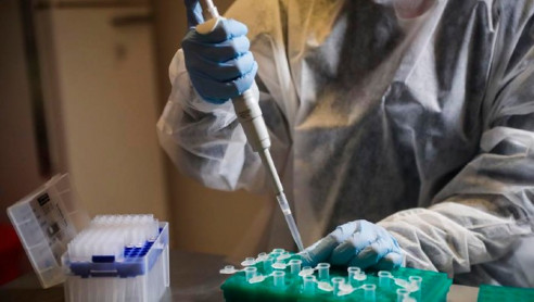 Murió un voluntario brasileño que participaba en las pruebas de la vacuna de AstraZeneca Actualidad