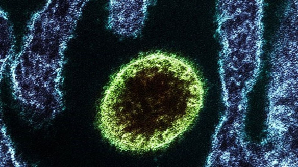 Virus 