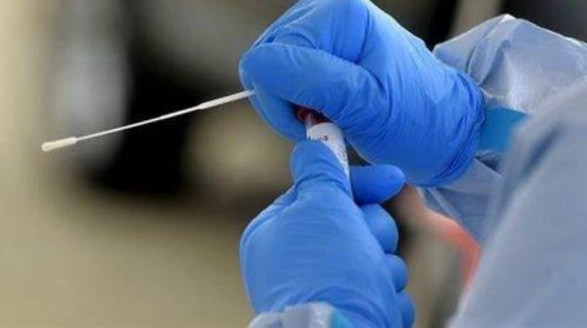 Chile supera los 10.000 casos activos de Covid-19: La mayor cifra desde julio Chile