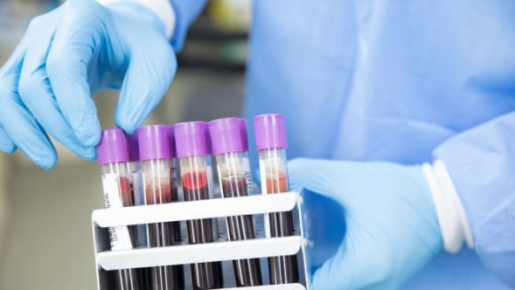 Desarrollan primer test de sangre que detecta el cáncer y si se ha diseminado por el cuerpo Salud