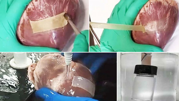 Nuevo parche de hidrogel doble cara podría reparar eficientemente corazones infartados Salud