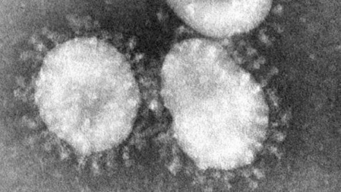 Dos mujeres mayores de 60 años son los primeros casos de coronavirus en Bolivia Latinoamérica