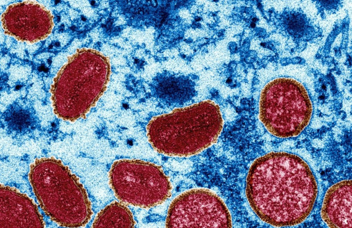 Confirman nueve casos de viruela del mono en Jalisco México