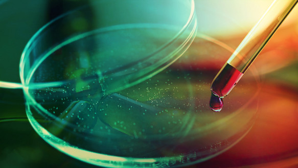 Confirman primera coinfección por VIH, viruela del mono y COVID-19 Salud