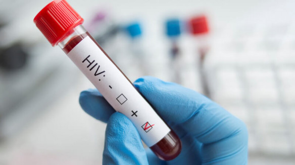 Moderna comenzó a probar en humanos vacuna experimental contra el VIH Salud
