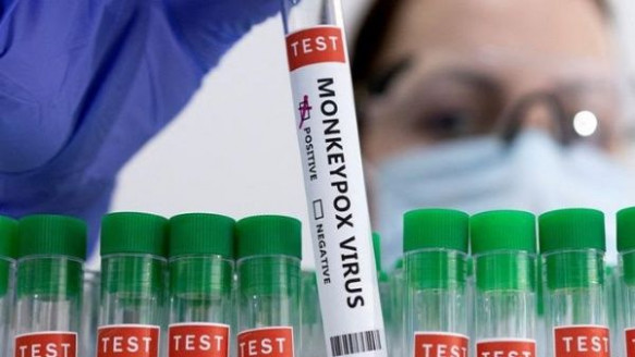 Australia declara emergencia sanitaria por ola de viruela símica Salud