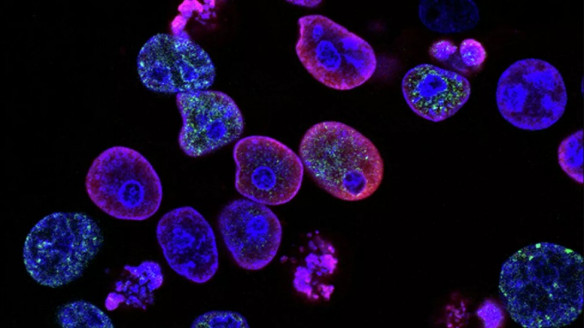 Ministerio de Salud ruso registra un radiofármaco para el diagnóstico de cáncer Salud