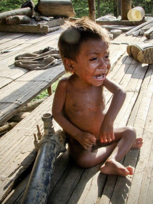 Las precarias condiciones y desnutrición que azotan al pueblo Wayú Latinoamérica