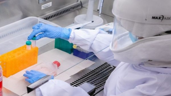 Reportan 273 casos de viruela del mono en Colombia Salud