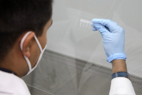 México: mil 367 casos de viruela símica en 30 estados México