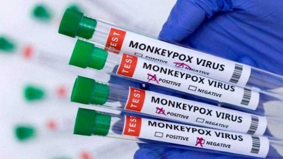 Suben a 66 los casos de viruela símica en Guatemala Salud