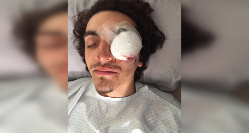 Universidad de Chile denunciará a Carabineros que agredieron a estudiante que perdió un ojo Latinoamérica
