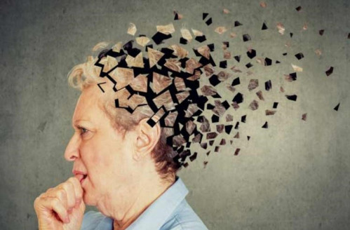 Alzheimer: Estudio revela que progresión de la enfermedad podría ser distinta entre machos y hembras Ciencia y Tecnología