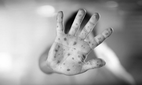 ¿Sólo se muere de COVID-19?: Siete vacunas olvidadas durante la pandemia Política