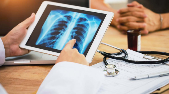 Hallan microplásticos en lo profundo de los pulmones por primera vez Salud