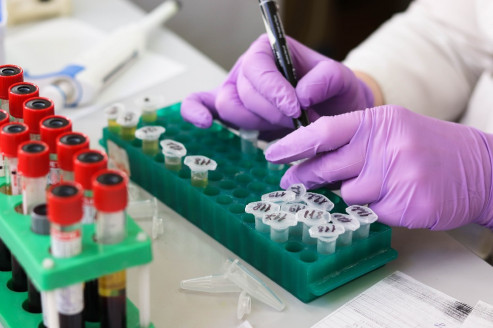 Descubren moléculas claves en el desarrollo de la enfermedad inflamatoria intestinal y el cáncer de colon Salud