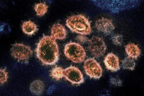 Sería más contagiosa: En Brasil detectan nueva variante de Covid-19 Latinoamérica