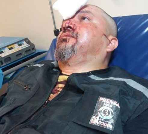 Carabineros disparó lacrimógena en cabeza de camarógrafo de La Victoria: Se suma a lumazo en rostro a reportera argentina #ChileDespertó