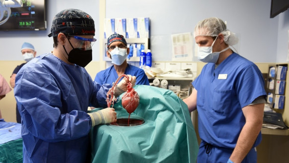 Implantan por primera vez en el mundo un corazón de cerdo a un humano Salud