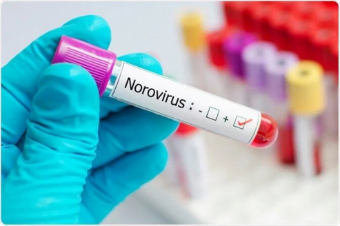 Más de 350 niños se contagiaron con norovirus en un colegio de Coquimbo Actualidad