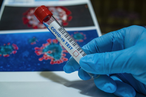 Covid-19: Estudio internacional evaluará impacto de la crisis sanitaria en personas con VIH Chile