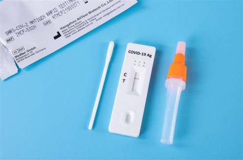 Crean una autoprueba de COVID-19 que emite el resultado en 30 minutos Salud