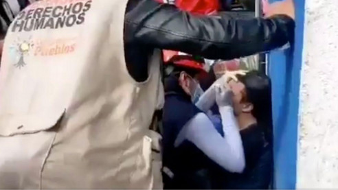 En riesgo de perder ojo joven que protestaba contra la brutalidad policial en Bogotá Colombia