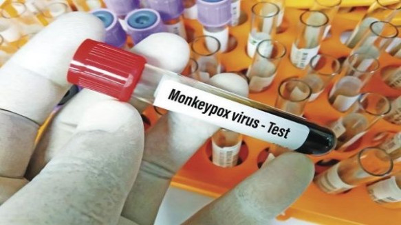 Paraguay reporta su primer caso de la viruela símica Salud